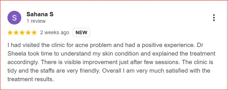 Google Review – Acne Treatment Experience at Tricho Derma Clinic