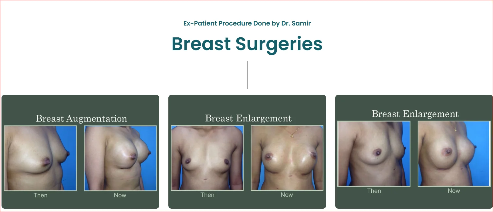Breast Surgery Before and After Results
