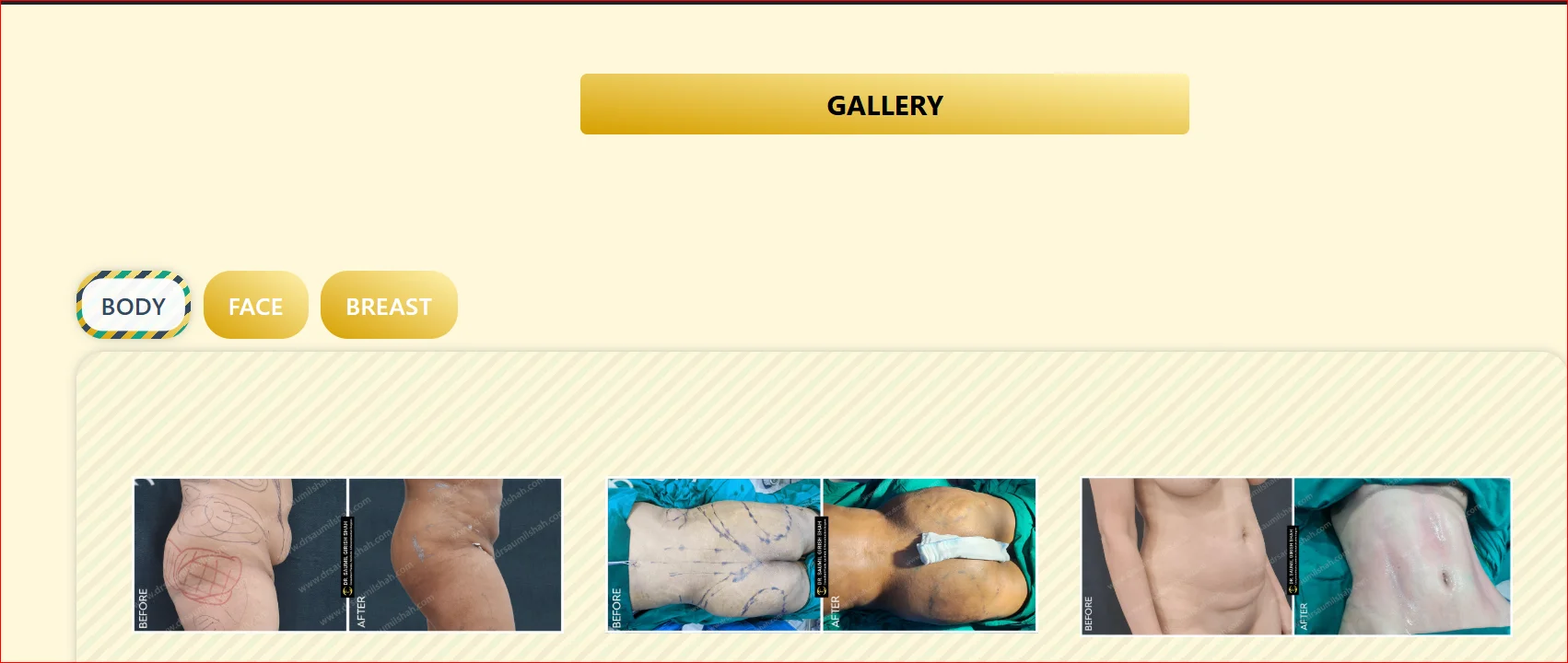 Plastic Surgery Before and After Gallery