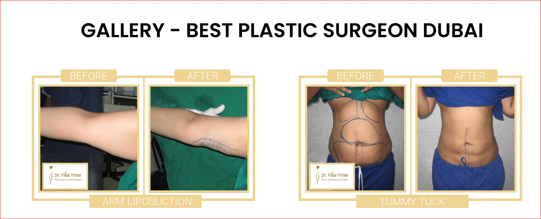 Plastic surgery before and after