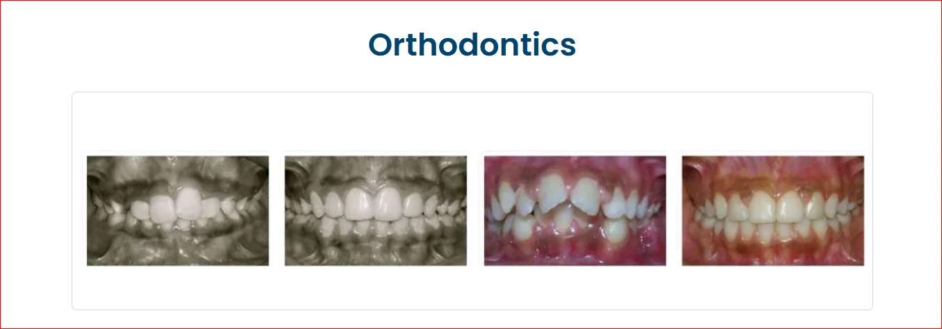 Orthodontics